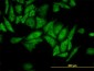 RPL4 / L4 Antibody (clone 4A3)
